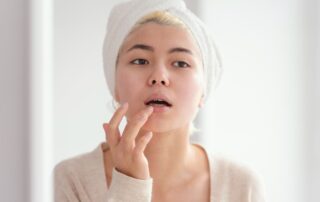 cara mengatasi bibir kering